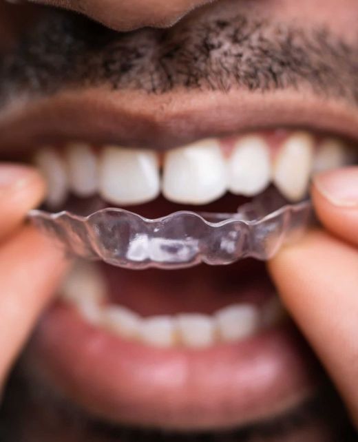 607a381f923ae7bf712d315f_AdobeStock_309502612-scaled